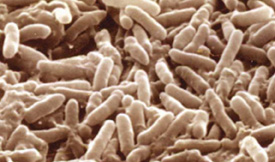 Fc 0712 Fd Desulfovibrio